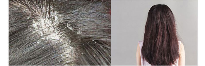 ���ϼ���-ɽ�����{(di��o)������